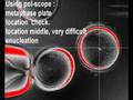 videos de using X-ray slit oocyte  enucleation