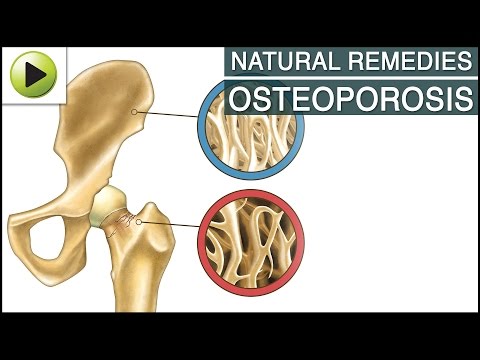 how to relieve osteoporosis pain