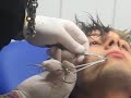 percing labbro (giuseppe)...onda calabra in deutschlandia!