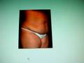 videos de tummy tuck-abdominoplasty-dr. kamal saleh-al emadi hospital-