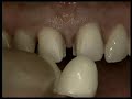 videos de odontologia