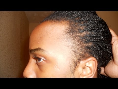 how to repair hair follicles