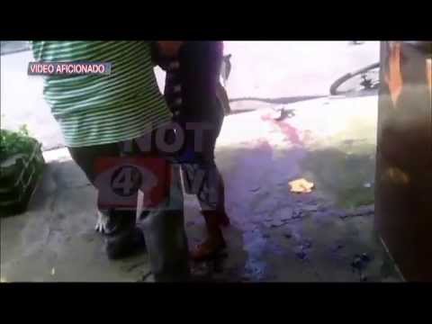 PERROS DE ATAQUE - El ataque se registró en Chalchuapa, departamento de Santa Ana.