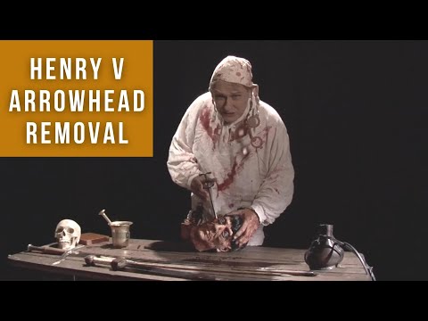 Henry V arrowhead removal | Medieval Surgery