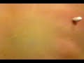 I laughed so hard at the reactions of the people in the background of this video. Warning: contains huge blackhead extraction! http://www.youtube.com/watch?v=s9CQ4TYo1N4&feature=youtube_gdata_player
