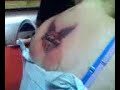 Hedley tat (2)