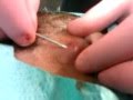 hit in face by pus!!!!