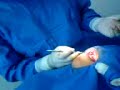 Cirugía Dental Cirugía Dental