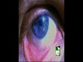 Parasites Parasites