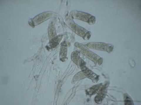 how to fasten excretion