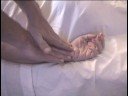 Effective Treatments for Carpal Tunnel - Review #2