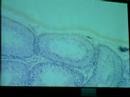 Testis