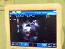 video 2 bebe Berdejo Urdaneta