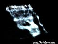 Waterfall 3D Waterfall 3D