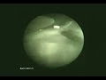 In Cylinder Video ( How a 4 stroke engine works ) In Cylinder Video ( How a 4 stroke engine works )