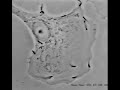 Listeria monocytogenes