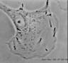 Listeria monocytogenes