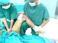Diminuishing Of A Hip Displacement Diminuishing Of A Hip Displacement