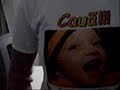Campanha em prol de Cauã (parte 2)