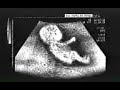 Ecco quello che facevo quando ancora ero in pancio della mamma...