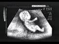 Bambini in pancia