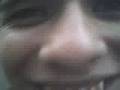 GONZA MAMADO 2 I UN ACCIDENTEE