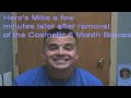 New Jersey Cosmetic Dentist Bruce Bilow: Testimonial-Mike