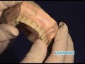 6. PROCESO BLANQUEAMIENTO DENTAL 6. PROCESO BLANQUEAMIENTO DENTAL
