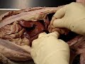 abdomen dissection abdomen dissection
