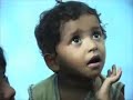 Spirulina to combat malnutrition Spirulina to combat malnutrition