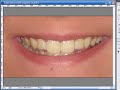 Secrets of Retouching Photos - Whiten Teeth Secrets of Retouching Photos - Whiten Teeth
