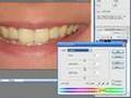 Secrets of Retouching Photos - Whiten Teeth