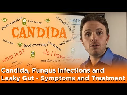 how to cure fungus candida