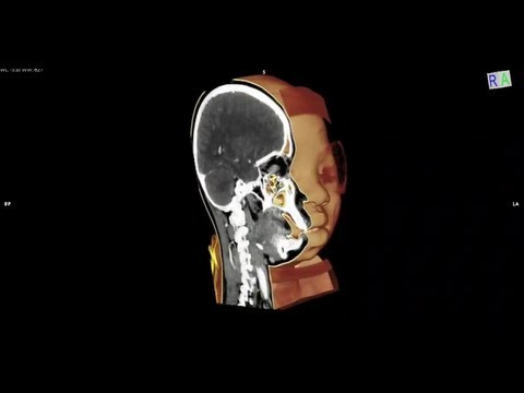how to repair ct scan machine