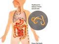 Top 10 Weirdest Diseases