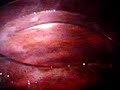 Rubidium and Cesium in water