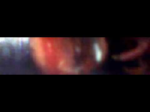 See video See video