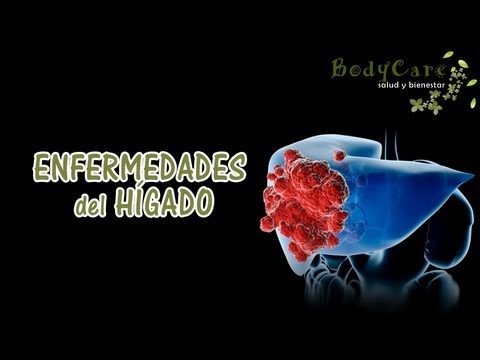 how to relieve biliary colic