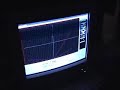 Argon laser doing 2 watts