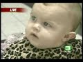 Dr. Ross - Chiropractic Cranial KCRA Dr. Ross - Chiropractic Cranial KCRA