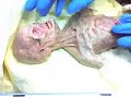 AUTOPSIA EXTRATERRESTRE!!!