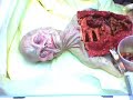AUTOPSIA EXTRATERRESTRE!!!
