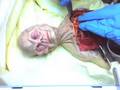 AUTOPSIA EXTRATERRESTRE!!!