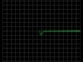 electro cardiogram electro cardiogram