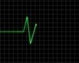 electro cardiogram
