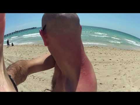 how to treat a portuguese man-o-war sting