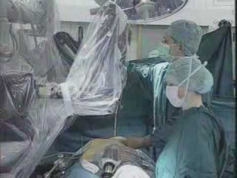 da Vinci Robotic Hysterectomy from ...