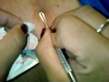 Worst black head ever