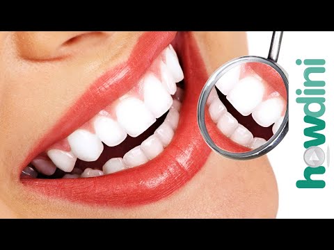how to whiten heavily stained teeth
