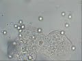 Amoeba Amoeba